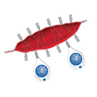 copy of copy of copy of copy of copy of copy of copy of copy of copy of copy of copy of copy of ACTIFUSE